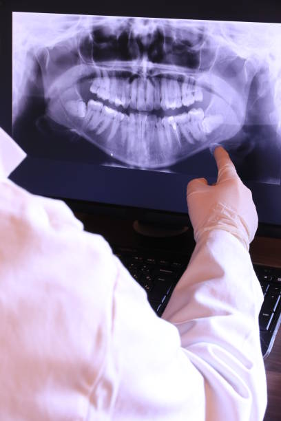 Best Dentist for Tooth Abscess  in Diboll, TX
