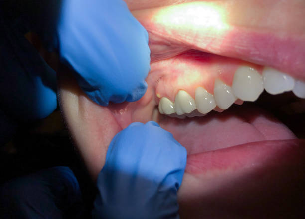 Best Knocked-Out Tooth Emergency  in Diboll, TX